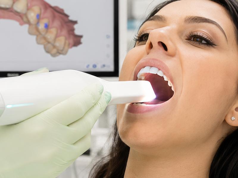 Intraorale Kamera für digitale Diagnostik