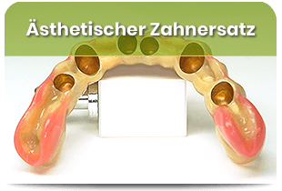 Ästhetische Zahnersatz