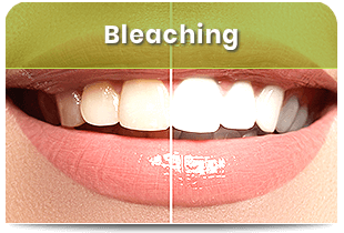 Bleaching