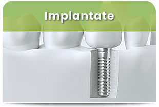Implantologie