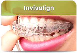 Invisalign