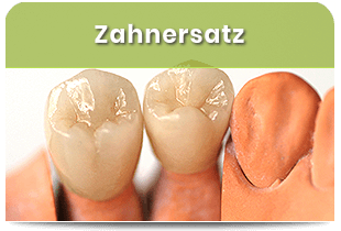 Zahnersatz