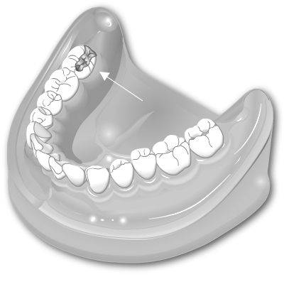 Amalgam