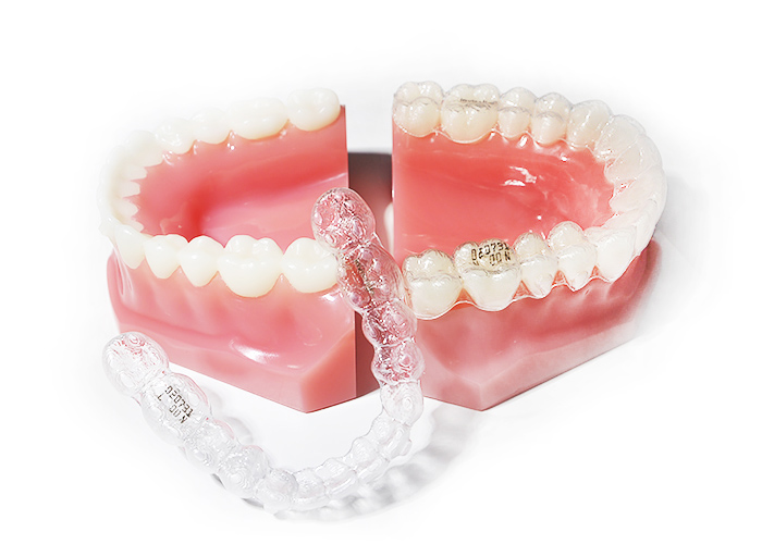 Invisalign